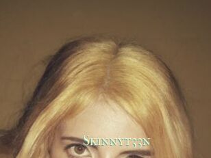 Skinnyt33n